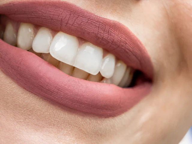 A close-up of a bright, even smile