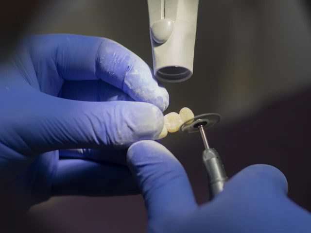 A dental technician finishing a ceramic crown restoration