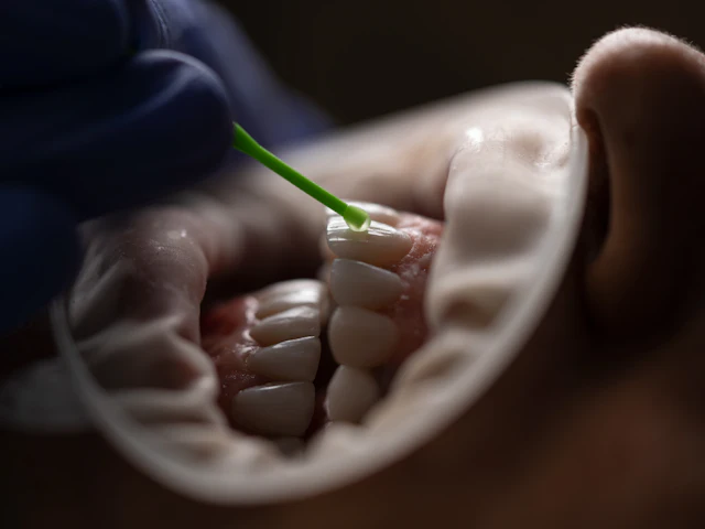 A dental light-tip instrument used on a patient’s teeth