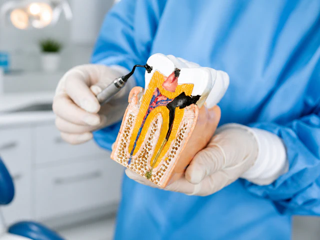 Dentist using a tooth model to explain the treatment plan